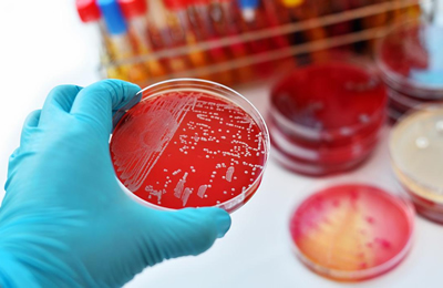 Infecciones Asociadas a la Atención en Salud (IAAS) Enfocado en Manejo de Pandemia Covid-9