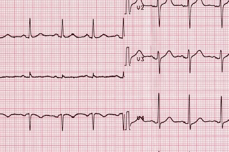 Curso de Capacitación “Electrocardiografía Básica”.